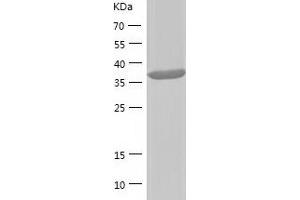 Western Blotting (WB) image for SUMO1 Activating Enzyme Subunit 1 (SAE1) (AA 1-346) protein (His tag) (ABIN7289210) (SAE1 Protein (AA 1-346) (His tag))