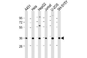 All lanes : Anti-NT5C3 Antibody (C-Term) at 1:2000 dilution Lane 1: A431 whole cell lysate Lane 2: Hela whole cell lysate Lane 3: HepG2 whole cell lysate Lane 4: Jurkat whole cell lysate Lane 5: U-2OS whole cell lysate Lane 6: SH-SY5Y whole cell lysate Lysates/proteins at 20 μg per lane. (NT5C3 antibody  (AA 282-313))