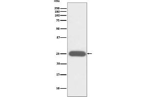 Western blot analysis of G-CSF expression in K562 cell lysate.