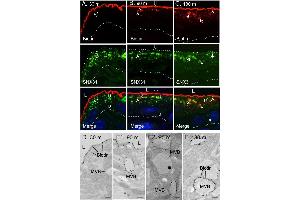 The endocytosed apical urothelial proteins are targeted to the SNX31-positive MVBs. (Biotin antibody)