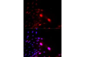 Immunofluorescence analysis of U2OS cells using DDB2 antibody (ABIN5970947). (DDB2 antibody)
