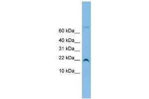 WB Suggested Anti-NHP2L1 Antibody Titration: 0. (NHP2L1 antibody  (N-Term))