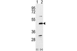 Western blot analysis of BMP7 antibody and 293 cell lysate either nontransfected (Lane 1) or transiently transfected with the BMP7 gene (2). (BMP7 antibody  (AA 15-44))