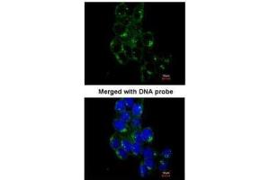 ICC/IF Image Immunofluorescence analysis of paraformaldehyde-fixed A431, using FYN, antibody at 1:200 dilution. (FYN antibody  (Center))