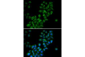 Immunofluorescence (IF) image for anti-Calcium Activated Nucleotidase 1 (CANT1) antibody (ABIN1980357) (CANT1 antibody)
