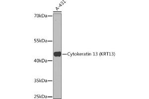 Western blot analysis of extracts of A-431 cells, using Cytokeratin 13 (Cytokeratin 13 (KRT13)) Rabbit pAb (ABIN7268090) at 1:1000 dilution. (Cytokeratin 13 antibody  (AA 269-458))