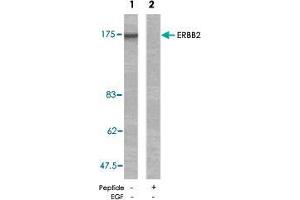 Western blot analysis of extracts from MDA-MB-231 cells using ERBB2 polyclonal antibody  .