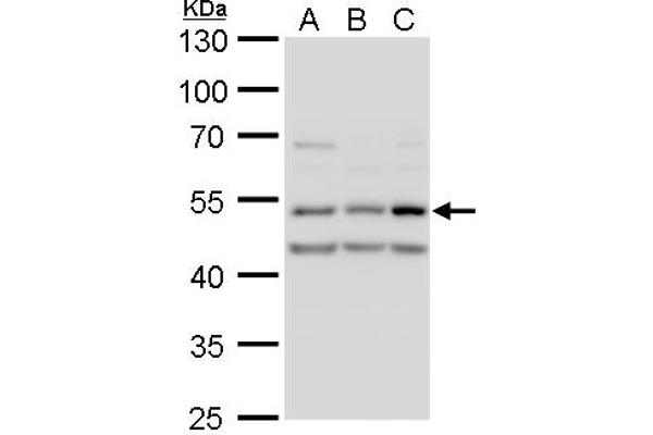 CAMK2D antibody