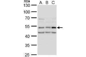 WB Image CaMK2D antibody detects CaMK2D protein by western blot analysis. (CAMK2D antibody)
