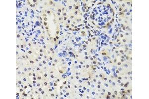 Immunohistochemistry (Paraffin-embedded Sections) (IHC (p)) image for anti-Elongation Factor Tu GTP Binding Domain Containing 2 (EFTUD2) antibody (ABIN7262991)