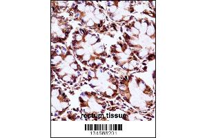 Immunohistochemistry (IHC) image for anti-Aryl Hydrocarbon Receptor Interacting Protein (AIP) (AA 293-321), (C-Term) antibody (ABIN5533225)