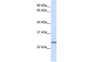 Western Blotting (WB) image for anti-Chromosome 12 Open Reading Frame 49 (C12orf49) antibody (ABIN2459339) (C12orf49 antibody)