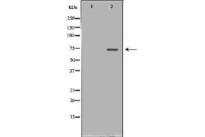 Western blot analysis of Hela whole cell lysates, using SDHA Antibody. (SDHA antibody  (Internal Region))