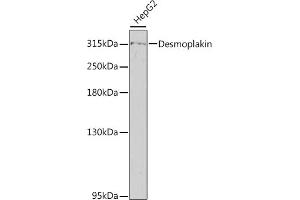 Western blot analysis of extracts of HepG2 cells, using Desmoplakin antibody (ABIN6134105, ABIN6139837, ABIN6139839 and ABIN6217243) at 1:800 dilution. (Desmoplakin antibody  (AA 2750-2850))