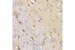 Immunohistochemistry of paraffin-embedded rat brain using SFRP2 antibody (ABIN5973117) at dilution of 1/200 (40x lens). (SFRP2 antibody)