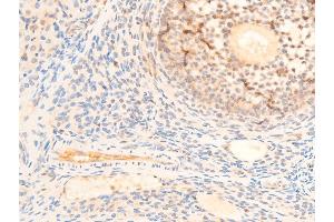 ABIN6267235 at 1/100 staining rat ovarian tissue sections by IHC-P. (PDPK1 antibody  (pSer241))