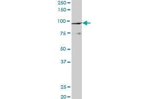 Western Blotting (WB) image for anti-K(lysine) Acetyltransferase 2B (KAT2B) (AA 353-452) antibody (ABIN522308)
