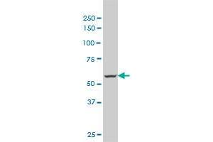 MTA1 monoclonal antibody (M02), clone 4D11. (MTA1 antibody  (AA 601-700))