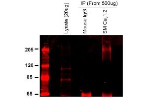 Immunoprecipitation (IP) image for anti-Calcium Channel, Voltage-Dependent, L Type, alpha 1C Subunit (CACNA1C) (AA 1507-1733) antibody (FITC) (ABIN2485657)