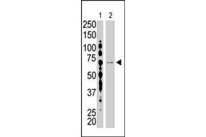 The USP2 polyclonal antibody  is used in Western blot to detect USP2 in HL-60 (lane 1) and USP2-transfected HeLa cell lysates (lane 2) . (USP2 antibody  (C-Term))