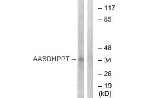 Western blot analysis of extracts from COLO cells, using AASDHPPT antibody.