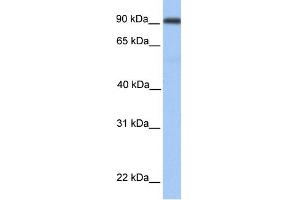 WB Suggested Anti-MMEL1 Antibody Titration:  0. (MMEL1 antibody  (Middle Region))