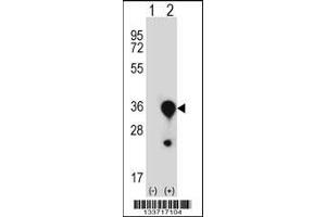 Western blot analysis of MBL2 using rabbit polyclonal MBL2 Antibody using 293 cell lysates (2 ug/lane) either nontransfected (Lane 1) or transiently transfected (Lane 2) with the MBL2 gene. (MBL2 antibody  (C-Term))