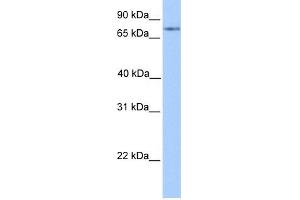 WB Suggested Anti-FOXO1 Antibody Titration:  0.