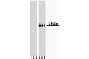 Western blot analysis of LAT (pY226) in human T lymphocytes. (LAT antibody  (pTyr226))