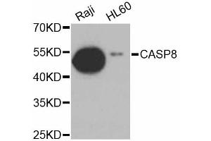 Western blot analysis of extracts of various cell lines, using CASP8 antibody. (Caspase 8 antibody)