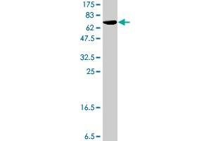 Western Blot detection against Immunogen (62. (SPDEF/PSE antibody  (AA 1-335))