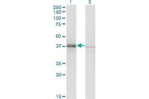 Western Blot analysis of SPO11 expression in transfected 293T cell line by SPO11 polyclonal antibody (A01).