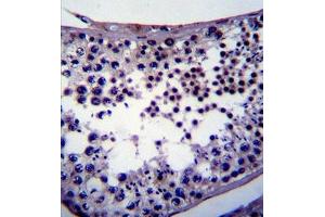 Immunohistochemistry (IHC) image for anti-Nanog Homeobox (NANOG) antibody (ABIN356386) (Nanog antibody)