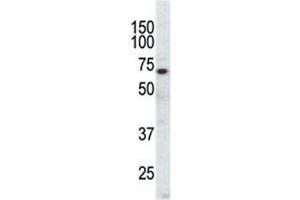 Western Blotting (WB) image for anti-EPH Receptor A3 (EPHA3) (AA 896-928) antibody (ABIN3030820)