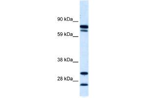WB Suggested Anti-ZNF606 Antibody Titration:  0.
