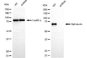 Western blotting analysis using optineurin antibody (ABIN7799705). (Recombinant OPTN antibody)