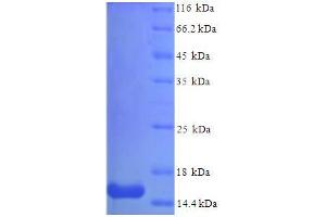 SDS-PAGE (SDS) image for Serum Amyloid A3 Pseudogene (SAA3P) (AA 20-122) protein (His tag) (ABIN5711069) (Serum Amyloid A3 Pseudogene (SAA3P) (AA 20-122) protein (His tag))