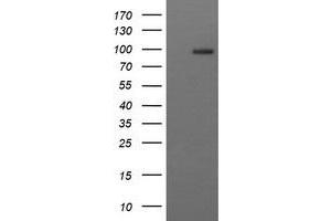 Image no. 2 for anti-CD22 Molecule (CD22) antibody (ABIN1497211) (CD22 antibody)