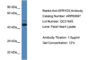 Western Blotting (WB) image for anti-SPRY Domain Containing 3 (SPRYD3) (N-Term) antibody (ABIN2788536) (SPRYD3 antibody  (N-Term))