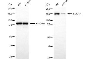 Western blotting analysis using SMC1A antibody (ABIN7800446).