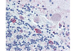 Anti-ERp72 antibody IHC of human brain, cerebellum. (PDIA4 antibody  (AA 623-638))