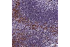 Immunohistochemical staining of human tonsil with CNEP1R1 polyclonal antibody  shows strong cytoplasmic positivity in subsets of cells outside germinal center at 1:20-1:50 dilution. (CTD Nuclear Envelope Phosphatase 1 Regulatory Subunit 1 (CNEP1R1) antibody)