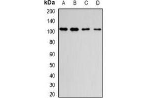 Western blot analysis of DPP8 expression in MCF7 (A), Hela (B), mouse brain (C), rat lung (D) whole cell lysates. (DPP8 antibody)
