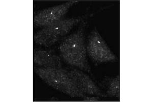 Immunofluorescence staining of Autophagy UVRAG Antibody  on Methanol-fixed HeLa cells.