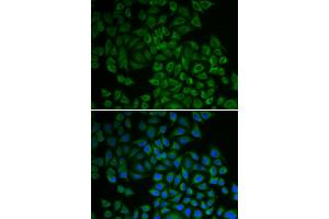 Immunofluorescence analysis of HeLa cells using SGK1 antibody (ABIN5970402). (SGK1 antibody)