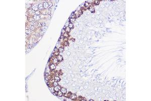 Immunohistochemistry of paraffin-embedded rat testis using DAZL Rabbit pAb (ABIN6130243, ABIN6139416, ABIN6139417 and ABIN6218163) at dilution of 1:100 (40x lens). (DAZL antibody  (AA 186-295))