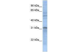 WB Suggested Anti-MTCH2  Antibody Titration: 0.