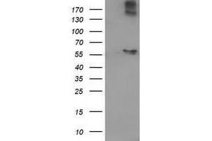 HEK293T cells were transfected with the pCMV6-ENTRY control (Left lane) or pCMV6-ENTRY ACOT12 (Right lane) cDNA for 48 hrs and lysed. (ACOT12 antibody)