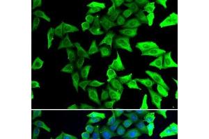Immunofluorescence analysis of U2OS cells using VSNL1 Polyclonal Antibody (VSNL1 antibody)