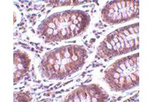 Immunohistochemistry of MICA in human colon tissue with MICA polyclonal antibody  at 10 ug/mL . (MICA antibody  (C-Term))